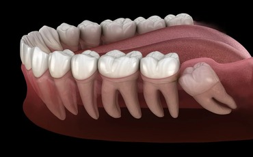 ORAL, DENTAL, AND JAW SURGERY